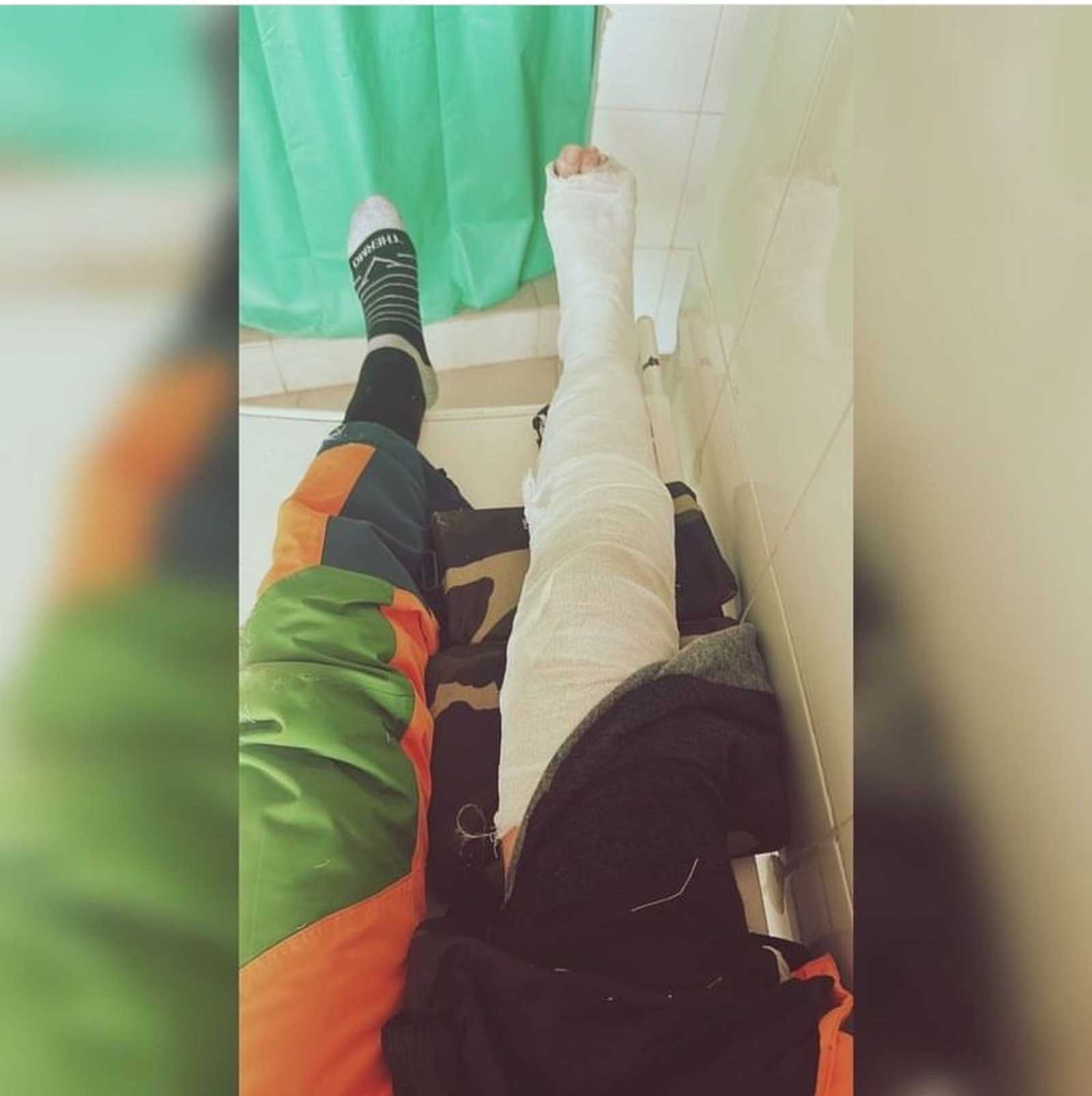 Лыжница из Уфы получила жуткий перелом на ГЛЦ «Аджигардак»